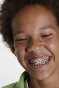 brackets